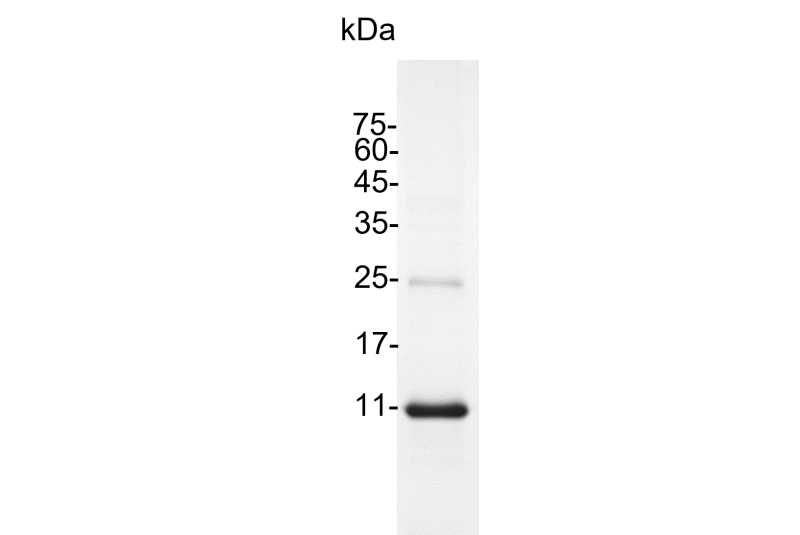 Human IL-4 (Interleukin-4) His-Tag GMP Grade Recombinant Protein
