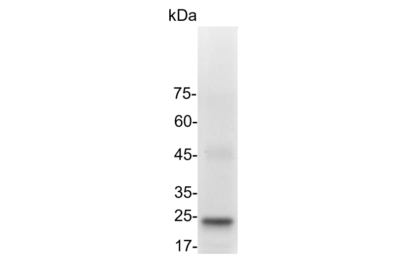 Human IL-6 (Interleukin-6) His-Tag GMP Grade Recombinant Protein