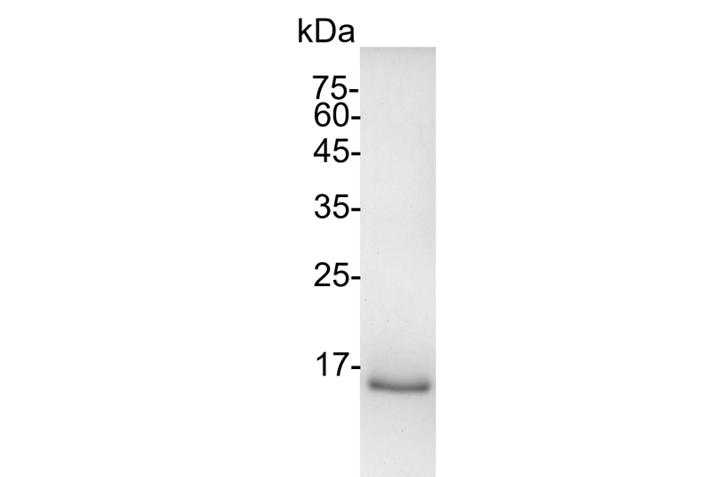 Human IL-21 (Interleukin-21) His-Tag GMP Grade Recombinant Protein