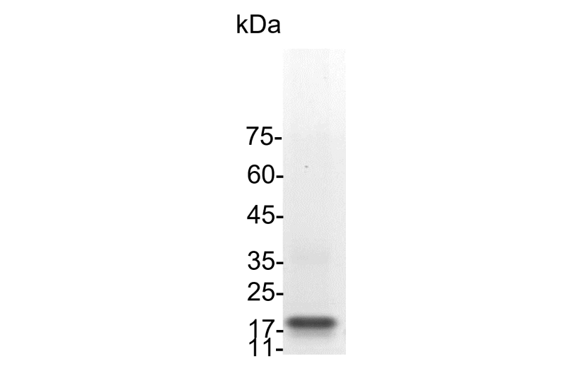 Human Flt-3 Ligand (Fms-related tyrosine kinase 3 ligand) His-Tag GMP Grade Recombinant Protein