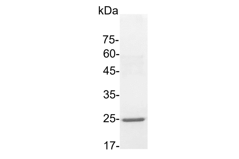 Human 4-1BBL His-Tag GMP Grade Recombinant Protein